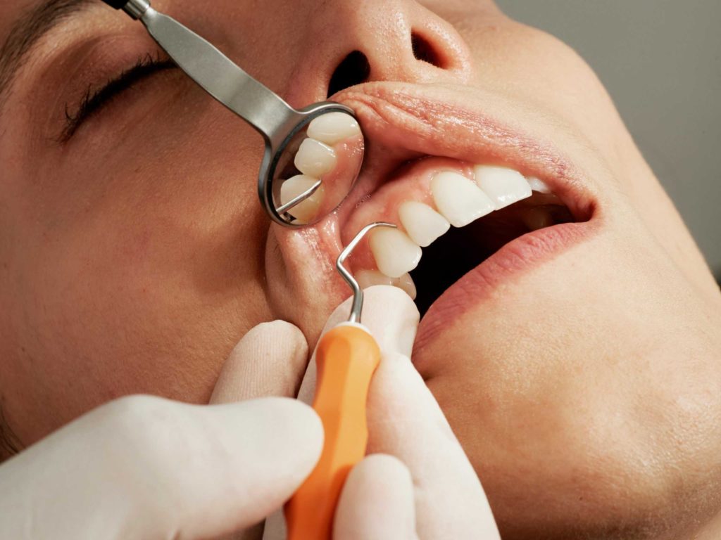 Examining dental patients gum